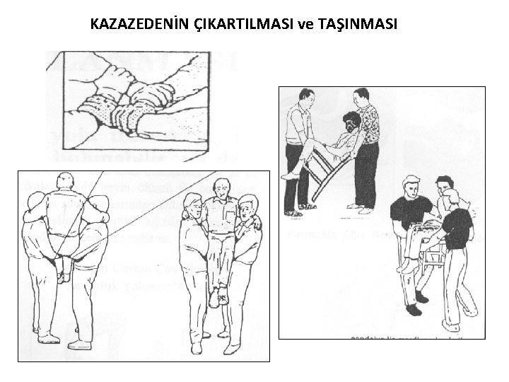 KAZAZEDENİN ÇIKARTILMASI ve TAŞINMASI 