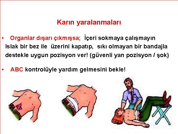 Karın yaralanmaları • • Organlar dışarı çıkmışsa; İçeri sokmaya çalışmayın Islak bir bez ile