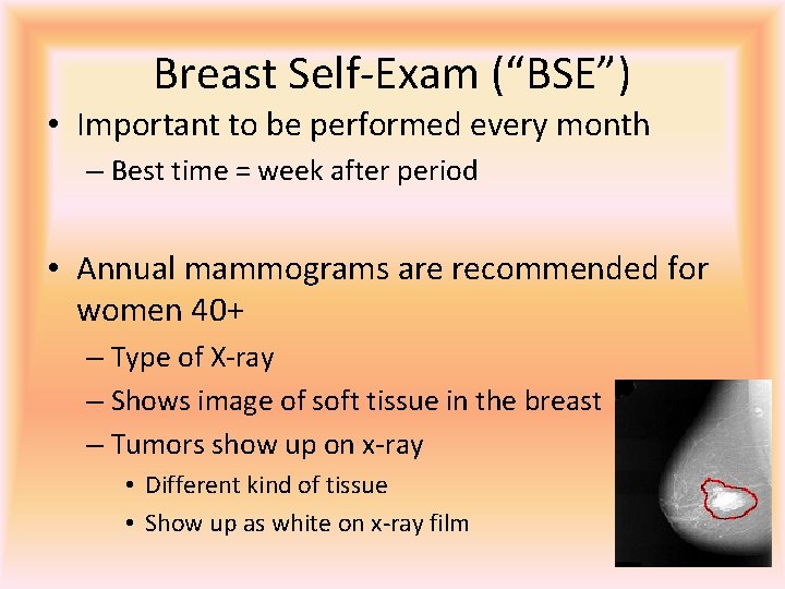 Breast Self-Exam (“BSE”) • Important to be performed every month – Best time =