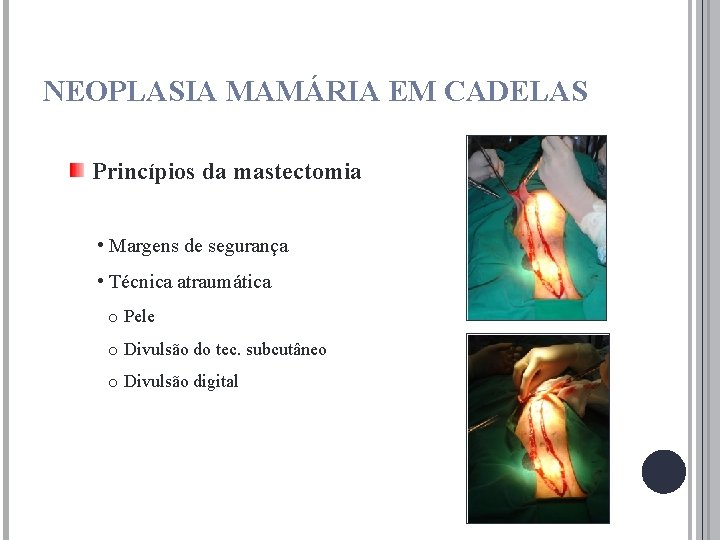 NEOPLASIA MAMÁRIA EM CADELAS Princípios da mastectomia • Margens de segurança • Técnica atraumática