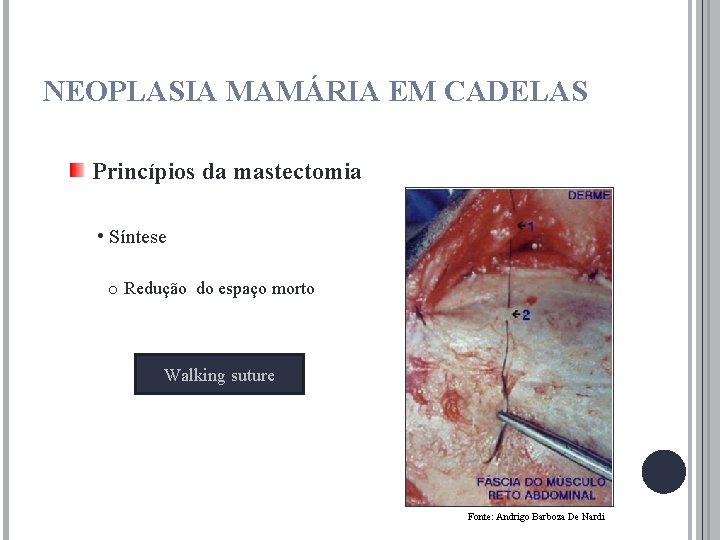 NEOPLASIA MAMÁRIA EM CADELAS Princípios da mastectomia • Síntese o Redução do espaço morto