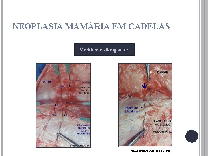 NEOPLASIA MAMÁRIA EM CADELAS Modified walking suture Fonte: Andrigo Barboza De Nardi 