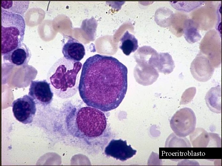 Proeritroblasto 