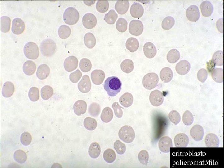 eritroblasto policromatófilo 