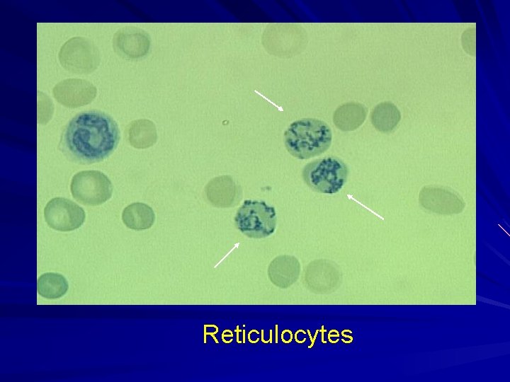 Reticulocytes 