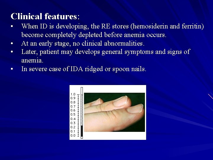 Clinical features: • • When ID is developing, the RE stores (hemosiderin and ferritin)
