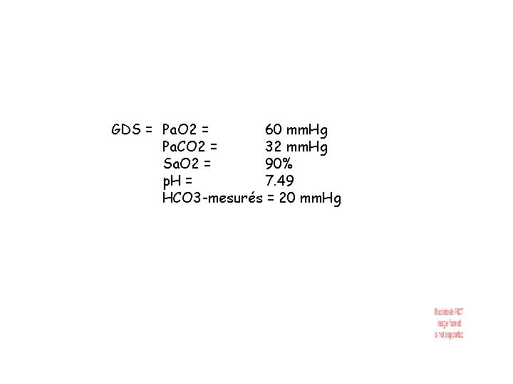 GDS = Pa. O 2 = 60 mm. Hg Pa. CO 2 = 32