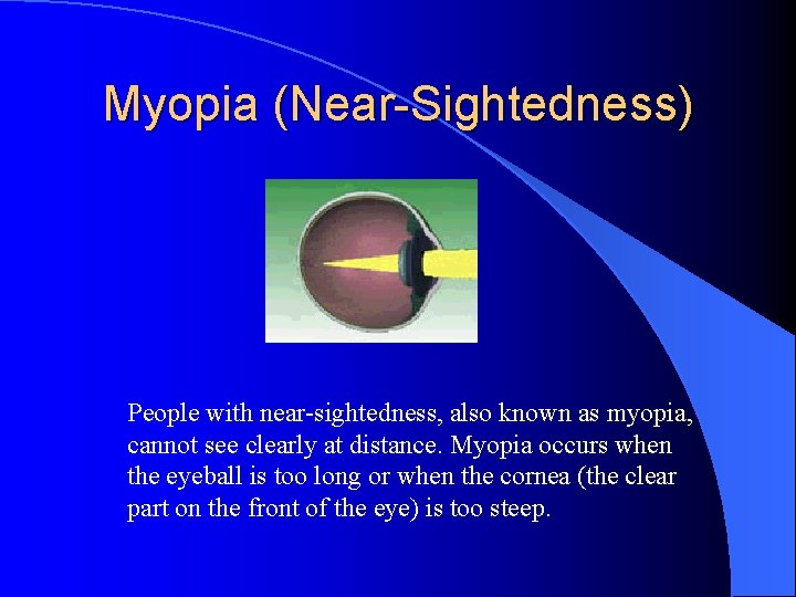 Myopia (Near-Sightedness) People with near-sightedness, also known as myopia, cannot see clearly at distance.