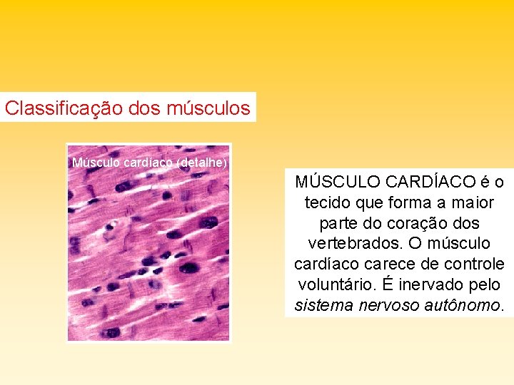 Classificação dos músculos Músculo cardíaco (detalhe) MÚSCULO CARDÍACO é o tecido que forma a