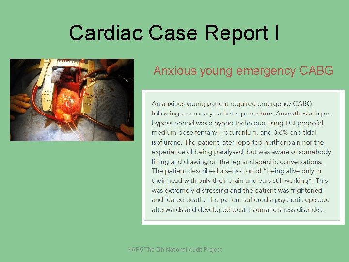 Cardiac Case Report I Anxious young emergency CABG NAP 5 The 5 th National