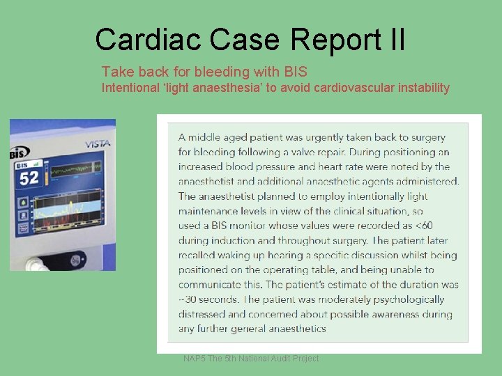 Cardiac Case Report II Take back for bleeding with BIS Intentional ‘light anaesthesia’ to