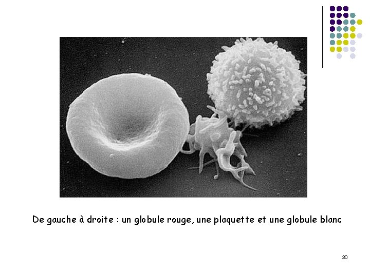 De gauche à droite : un globule rouge, une plaquette et une globule blanc