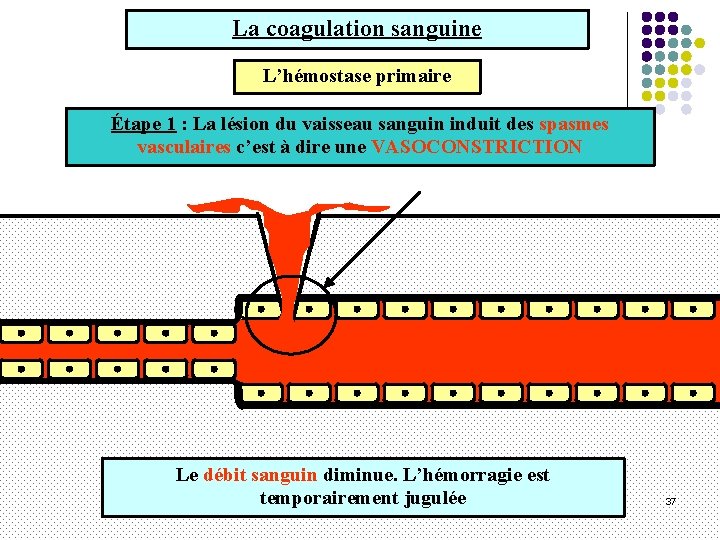 La coagulation sanguine L’hémostase primaire Étape 1 : La lésion du vaisseau sanguin induit