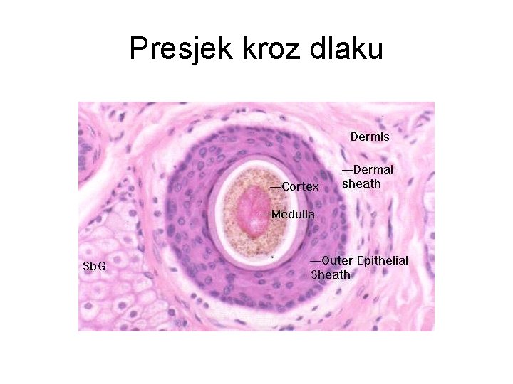 Presjek kroz dlaku 