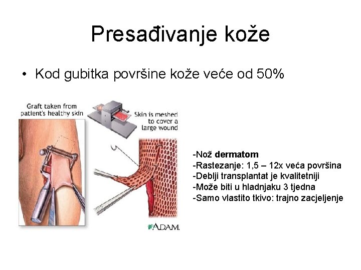 Presađivanje kože • Kod gubitka površine kože veće od 50% -Nož dermatom -Rastezanje: 1,