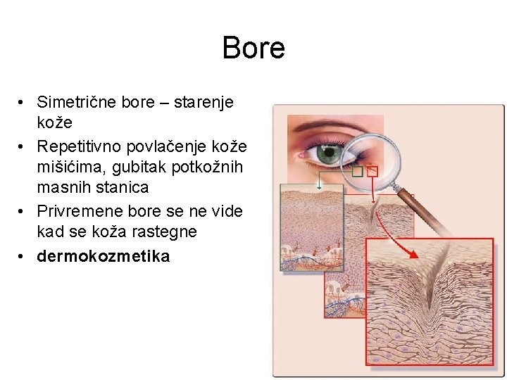 Bore • Simetrične bore – starenje kože • Repetitivno povlačenje kože mišićima, gubitak potkožnih