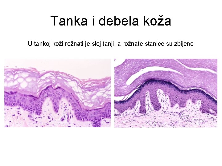 Tanka i debela koža U tankoj koži rožnati je sloj tanji, a rožnate stanice Tanka i debela koža U tankoj koži rožnati je sloj tanji, a rožnate stanice
