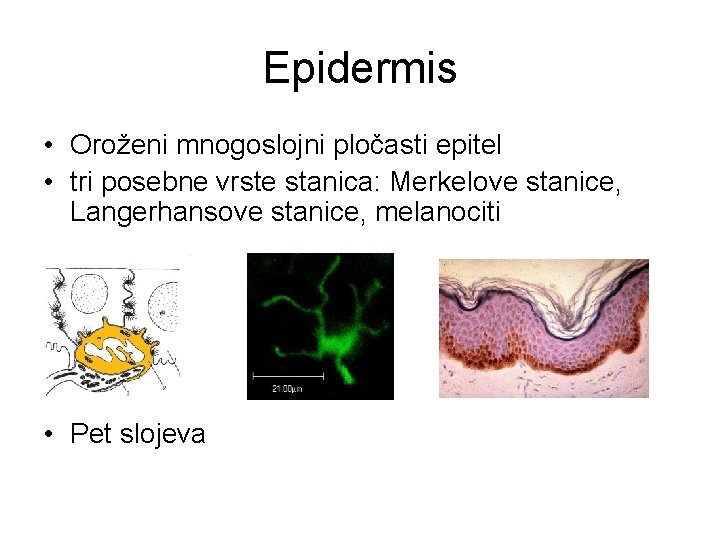Epidermis • Oroženi mnogoslojni pločasti epitel • tri posebne vrste stanica: Merkelove stanice, Langerhansove Epidermis • Oroženi mnogoslojni pločasti epitel • tri posebne vrste stanica: Merkelove stanice, Langerhansove