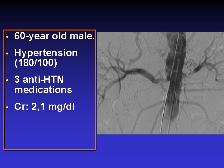  • 60 -year old male. • Hypertension (180/100) • 3 anti-HTN medications •