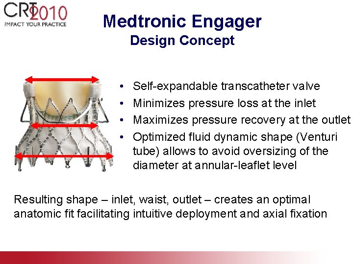 Medtronic Engager Design Concept • • Self-expandable transcatheter valve Minimizes pressure loss at the