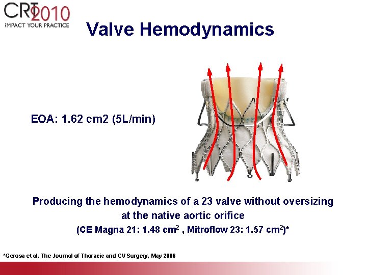 Valve Hemodynamics EOA: 1. 62 cm 2 (5 L/min) Producing the hemodynamics of a