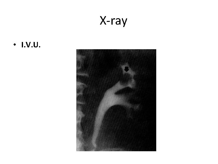 X-ray • I. V. U. 