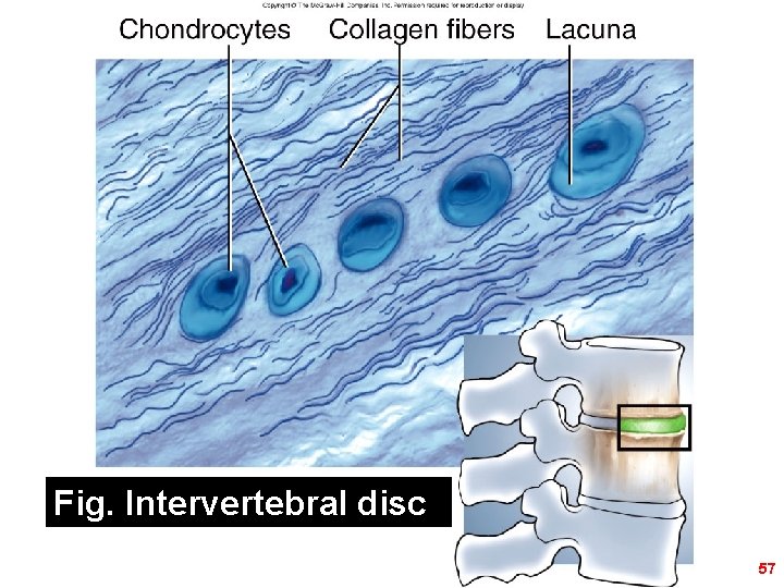 Figure 5. 21 b Fig. Intervertebral disc 57 