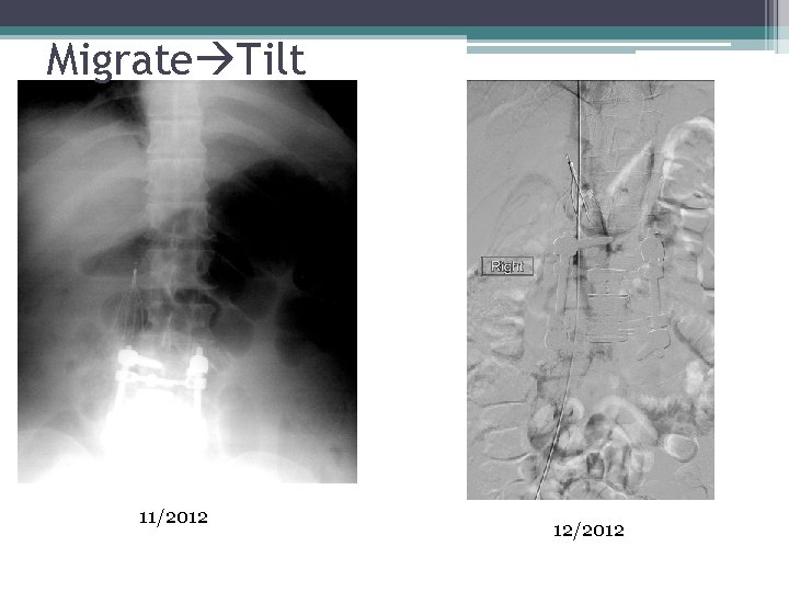 Migrate Tilt 11/2012 12/2012 