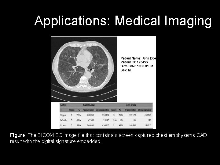 Applications: Medical Imaging Figure: The DICOM SC image file that contains a screen-captured chest