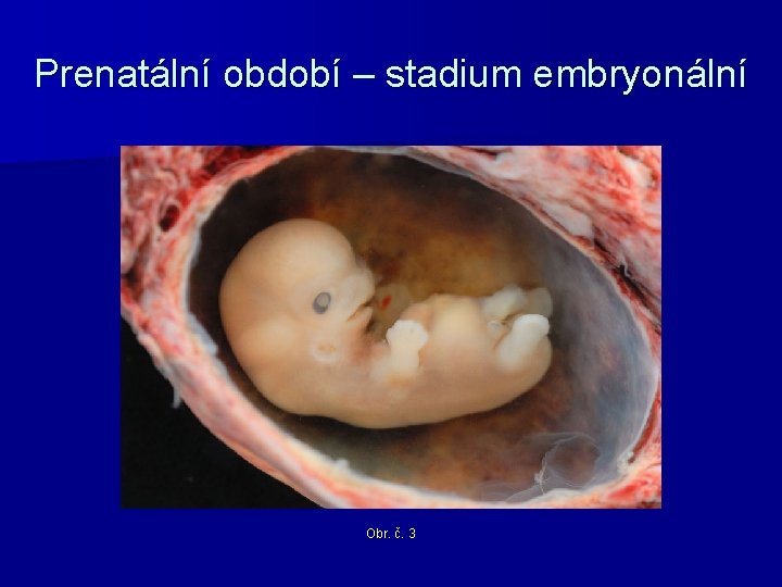 Prenatální období – stadium embryonální Obr. č. 3 