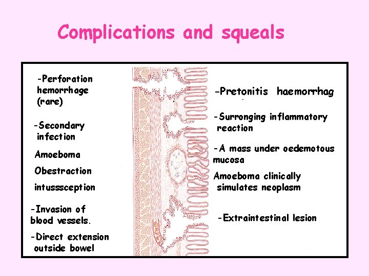 Complications and squeals -Perforation hemorrhage (rare) -Secondary infection Amoeboma Obestraction intusssception -Invasion of blood