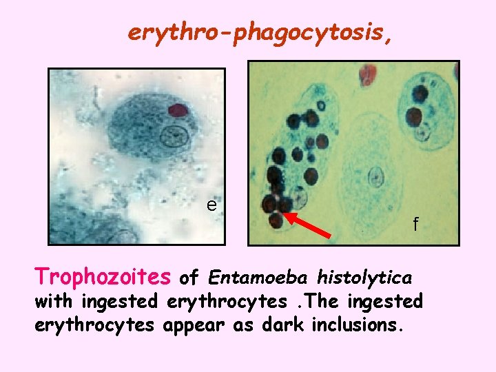 erythro-phagocytosis, e Trophozoites of Entamoeba histolytica f with ingested erythrocytes. The ingested erythrocytes appear