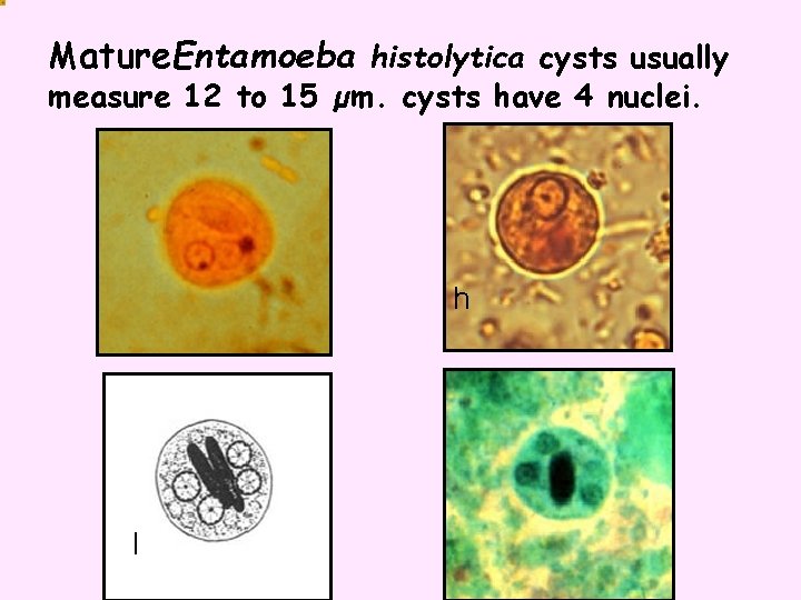 Mature. Entamoeba histolytica cysts usually measure 12 to 15 µm. cysts have 4 nuclei.