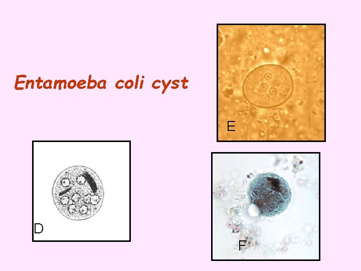 Entamoeba coli cyst E D F 