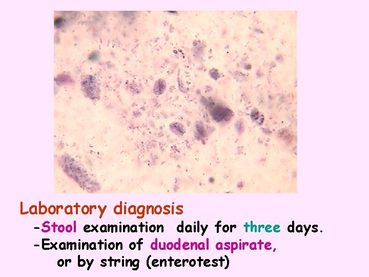 Laboratory diagnosis -Stool examination daily for three days. -Examination of duodenal aspirate, or by