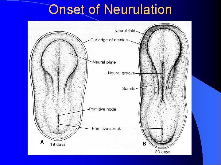 Onset of Neurulation 