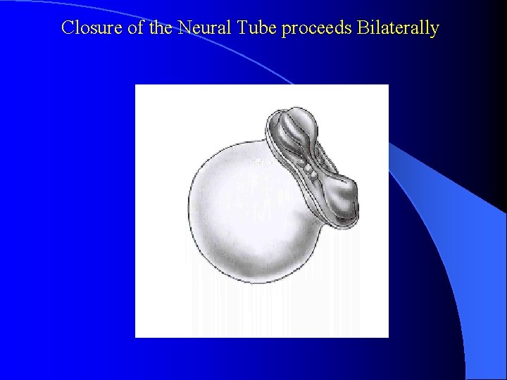  Closure of the Neural Tube proceeds Bilaterally 