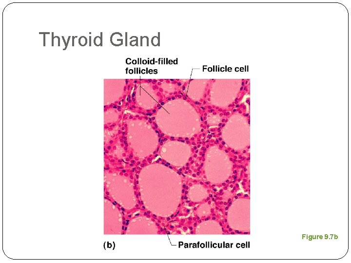 Thyroid Gland Figure 9. 7 b 