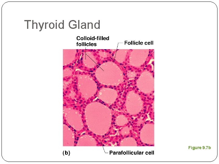 Thyroid Gland Figure 9. 7 b 