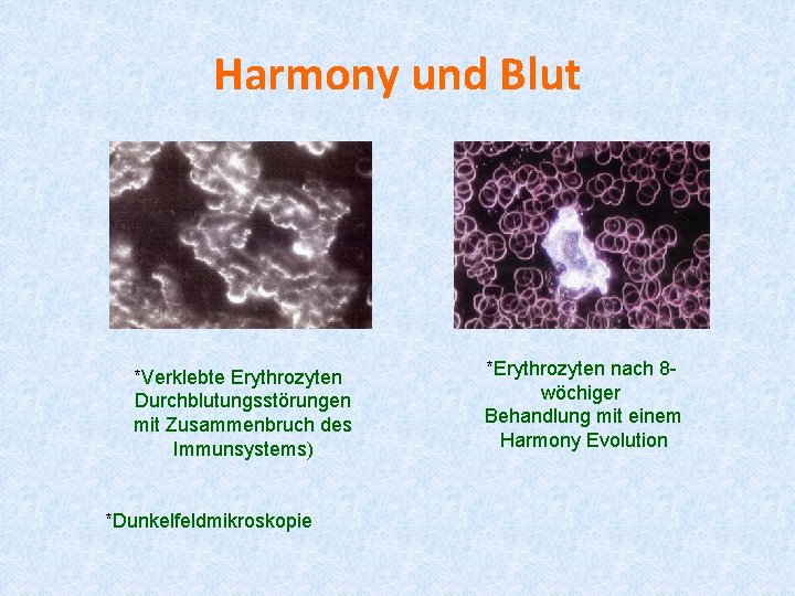 Harmony und Blut *Verklebte Erythrozyten Durchblutungsstörungen mit Zusammenbruch des Immunsystems) *Dunkelfeldmikroskopie *Erythrozyten nach 8