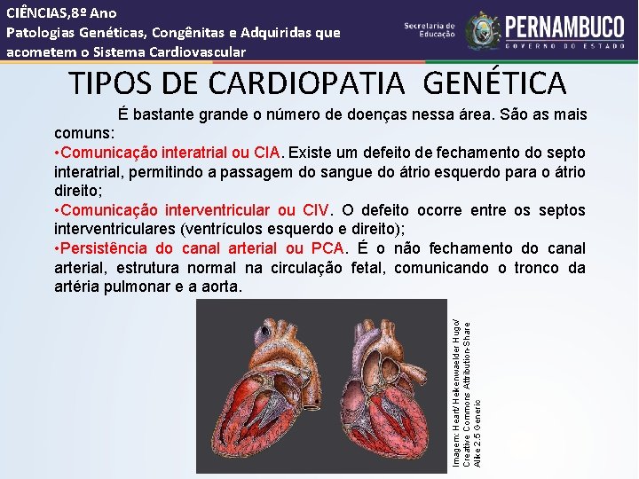 CIÊNCIAS, 8º Ano Patologias Genéticas, Congênitas e Adquiridas que acometem o Sistema Cardiovascular TIPOS
