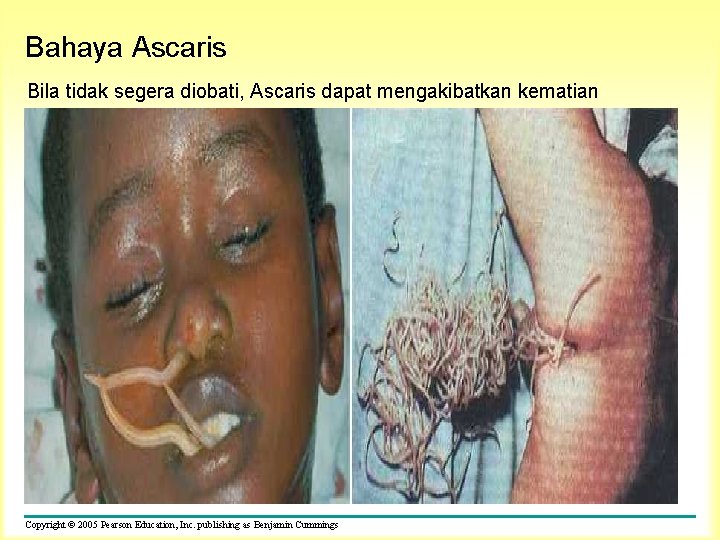 Bahaya Ascaris Bila tidak segera diobati, Ascaris dapat mengakibatkan kematian Copyright © 2005 Pearson