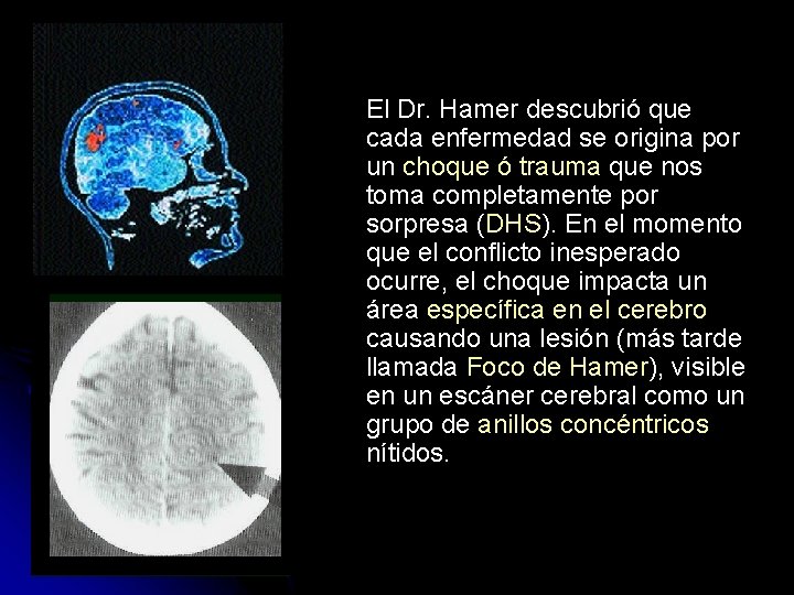 El Dr. Hamer descubrió que cada enfermedad se origina por un choque ó trauma