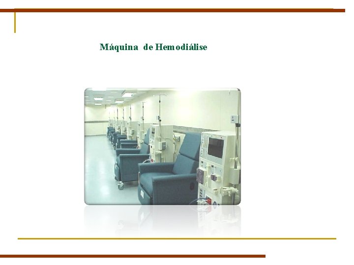 Máquina de Hemodiálise Máquina de Hemodiálise