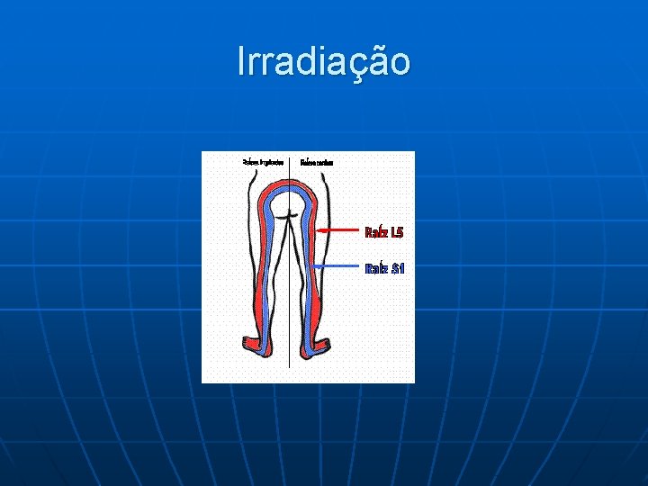 Irradiação 