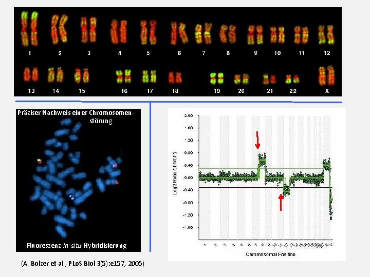 Präziser Nachweis einer Chromosomenstörung Fluoreszenz-in-situ-Hybridisierung (A. Bolzer et al. , PLo. S Biol 3(5):