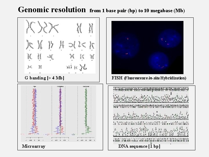 Genomic resolution G banding [> 4 Mb] Microarray from 1 base pair (bp) to