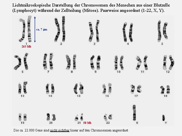 Lichtmikroskopische Darstellung der Chromosomen des Menschen aus einer Blutzelle (Lymphocyt) während der Zellteilung (Mitose).