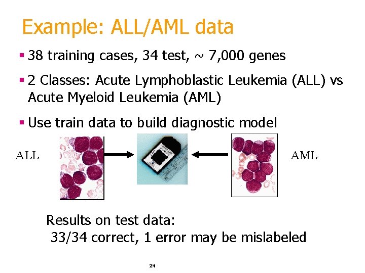 Example: ALL/AML data § 38 training cases, 34 test, ~ 7, 000 genes § Example: ALL/AML data § 38 training cases, 34 test, ~ 7, 000 genes §