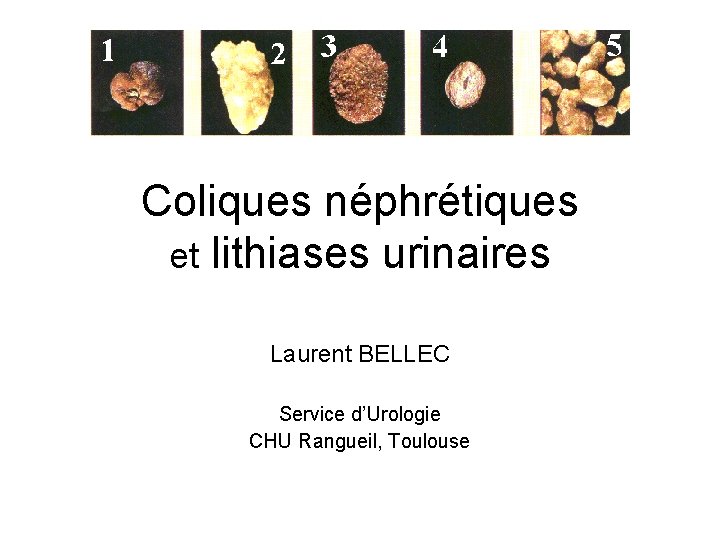 Coliques néphrétiques et lithiases urinaires Laurent BELLEC Service d’Urologie CHU Rangueil, Toulouse 